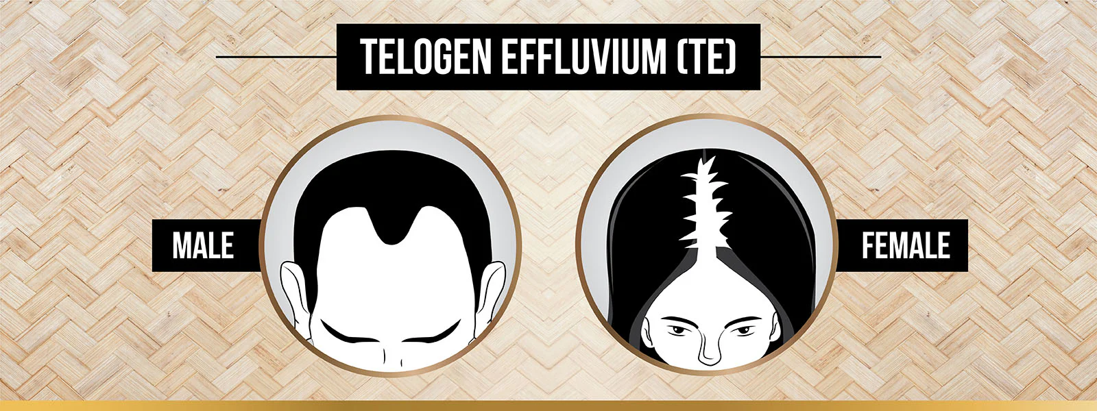 Telogen effluvium (te)